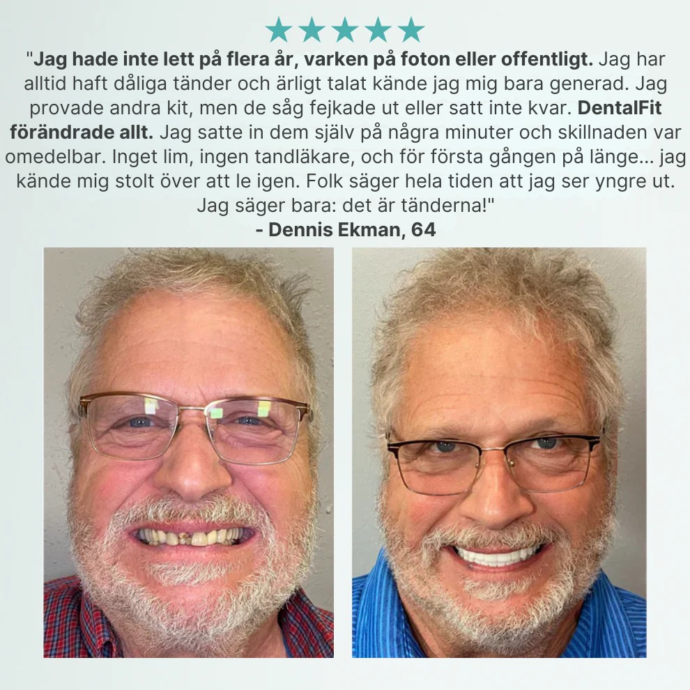 DentalFit™ Specialanpassade Fullfunktionella Tandproteser